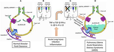 Regulation of Lung Epithelial Sodium Channels by Cytokines and Chemokines